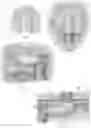 Fig. 02 - Pre-formed parastomal hernia reinforcement mesh