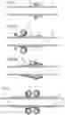 Fig. 04 - IMPLANTABLE TISSUE CONNECTOR
