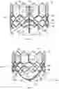 Fig. 04 - SUTURE WITH APERTURE FOR USE IN PROSTHETIC DEVICES