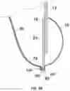 Fig. 06 - SUTURE WITH APERTURE FOR USE IN PROSTHETIC DEVICES