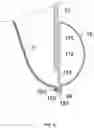 Fig. 07 - SUTURE WITH APERTURE FOR USE IN PROSTHETIC DEVICES