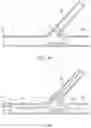 Fig. 06 - Multi-stent and multi-balloon apparatus for treating bifurcations and methods of use