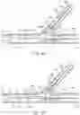 Fig. 07 - Multi-stent and multi-balloon apparatus for treating bifurcations and methods of use