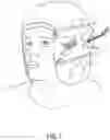 Fig. 02 - Headwear with Storable Accessory