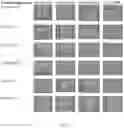 Fig. 02 - FLOWABLE FIBRINOGEN THROMBIN PASTE