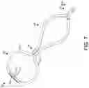 Fig. 08 - NASAL CANNULA