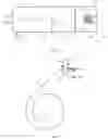 Fig. 06 - System for effecting and controlling oscillatory pressure within balloon catheters for fatigue fracture of calculi