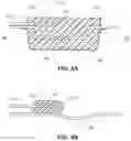 Fig. 09 - METHODS AND DEVICES FOR NERVE REGENERATION