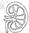 Fig. 01 - INTRA-KIDNEY STONE DISRUPTOR