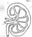 Fig. 02 - INTRA-KIDNEY STONE DISRUPTOR