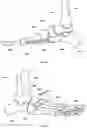Fig. 11 - EXERCISE APPARATUS AND METHOD OF PHYSIOTHERAPY
