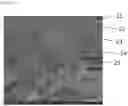 Fig. 04 - Mechanically stable ultrafiltration membrane, and method for producing same