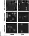 Fig. 85 - COMPOSITIONS AND METHODS FOR DETECTING CELLS UNDERGOING FERROPTOSIS USING AN ANTIBODY