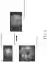 Fig. 09 - Systems and methods for superimposing virtual image on real-time image