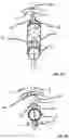 Fig. 03 - On-load tap changer