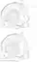 Fig. 02 - HIGH-PROFILE, ANATOMY-SPECIFIC CRANIOFACIAL IMPLANTS FOR COMBINED HARD AND SOFT TISSUE RECONSTRUCTION WITH EMBEDDED TECHNOLOGY FOR MEDICINE DELIVERY