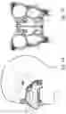Fig. 02 - Treatment of headache disorders