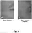 Fig. 02 - STEM CELL STIMULATING COMPOSITIONS AND METHODS
