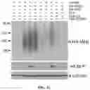 Fig. 03 - REGULATION OF RAN TRANSLATION BY PKR AND EIF2A-P PATHWAYS
