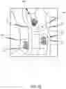 Fig. 06 - METHODS AND APPARATUS FOR  TRACKING AGENTS DURING A PROCEDURE