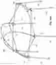 Fig. 97 - Foldable playard having X-frame assemblies, oval-shaped leg assemblies, and canopy cover