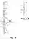 Fig. 06 - COIL CATHETER, METHOD OF USE, AND METHOD OF MANUFACTURE