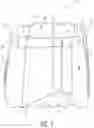 Fig. 02 - ABSORBENT ARTICLE WITH REFASTENABLE SIDE SEAMS AND METHOD OF MANUFACTURING