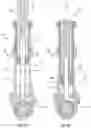 Fig. 04 - Turbine and multi piston pump