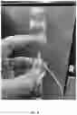 Fig. 05 - INTRA-ARTICULAR NEEDLE PLACEMENT DEVICE AND METHOD OF USING
