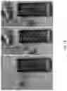 Fig. 14 - INTRA-ARTICULAR NEEDLE PLACEMENT DEVICE AND METHOD OF USING