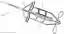 Fig. 01 - TRANSCATHETER VALVE LACERATION DEVICE AND METHOD