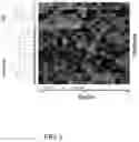 Fig. 08 - METHOD AND SYSTEM OF DIAGNOSING AND TREATING NEURODEGENERATIVE DISEASE AND SEIZURES