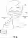 Fig. 03 - ABSORPTION ENHANCING WEARABLE DEVICE