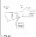 Fig. 05 - ABSORPTION ENHANCING WEARABLE DEVICE