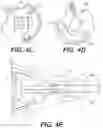 Fig. 05 - MEDICAL DEVICE WITH MULTIPLE DEGREES OF FREEDOM AND RELATED METHODS