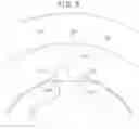 Fig. 06 - TORQUE SENSOR