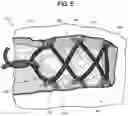 Fig. 06 - UPPER FOR AN ARTICLE OF FOOTWEAR HAVING AN INNER COMPONENT AND A SHROUD