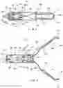 Fig. 03 - Hemostasis clip short system