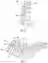 Fig. 10 - Surgical robot with anti-skive feature