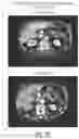 Fig. 09 - IMPROVED METHODS, KITS, COMPOSITIONS AND DOSING REGIMENS FOR THE USE OF HETEROCYCLIC INHIBITORS OF ERK1 AND ERK2