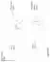Fig. 46 - Eye imaging in head worn computing