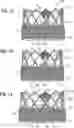 Fig. 09 - MULTI-LAYER COVERING FOR A PROSTHETIC HEART VALVE