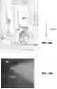 Fig. 44 - Systems, devices, and methods related to the individualized calibration and/or manufacturing of medical devices