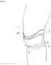 Fig. 02 - HEAT GENERATOR FOR KNEES