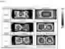 Fig. 06 - HEAT GENERATOR FOR KNEES