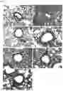 Fig. 02 - STERICALLY STABILIZED CARRIER FOR AEROSOL THERAPEUTICS, COMPOSITIONS AND METHODS FOR TREATING THE RESPIRATORY TRACT OF A MAMMAL