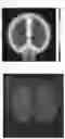 Fig. 02 - Electric heater