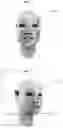 Fig. 02 - PHOTOTHERAPY FACE MASK