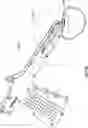 Fig. 40 - BONE REPAIR DEVICES AND METHODS