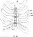 Fig. 44 - BONE REPAIR DEVICES AND METHODS